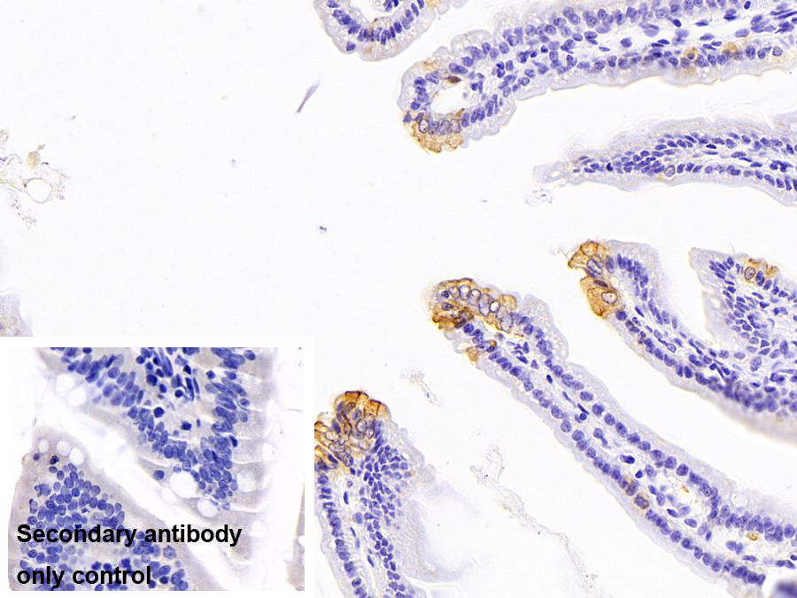 Polyclonal Antibody to Keratin 2 (CK2)