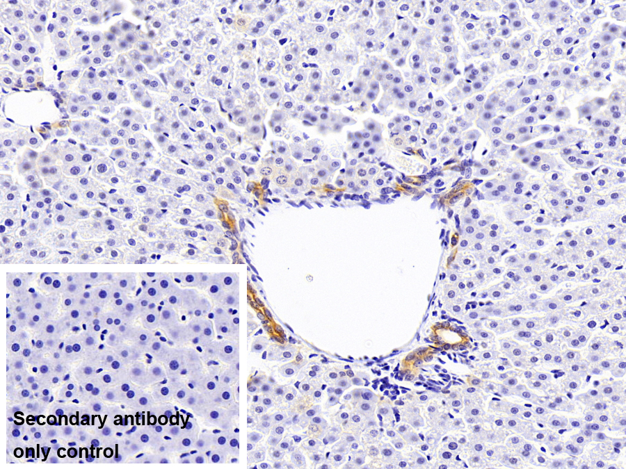 Polyclonal Antibody to Keratin 2 (CK2)