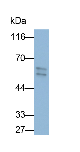 Polyclonal Antibody to Keratin 2 (CK2)