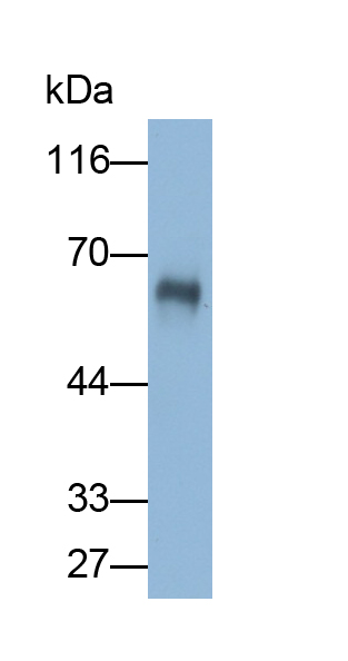 Polyclonal Antibody to Keratin 2 (CK2)