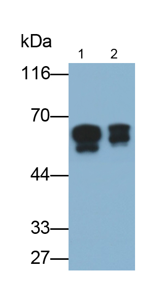 Polyclonal Antibody to Cytokeratin 1 (CK1)