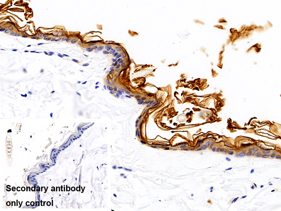 Polyclonal Antibody to Cytokeratin 1 (CK1)