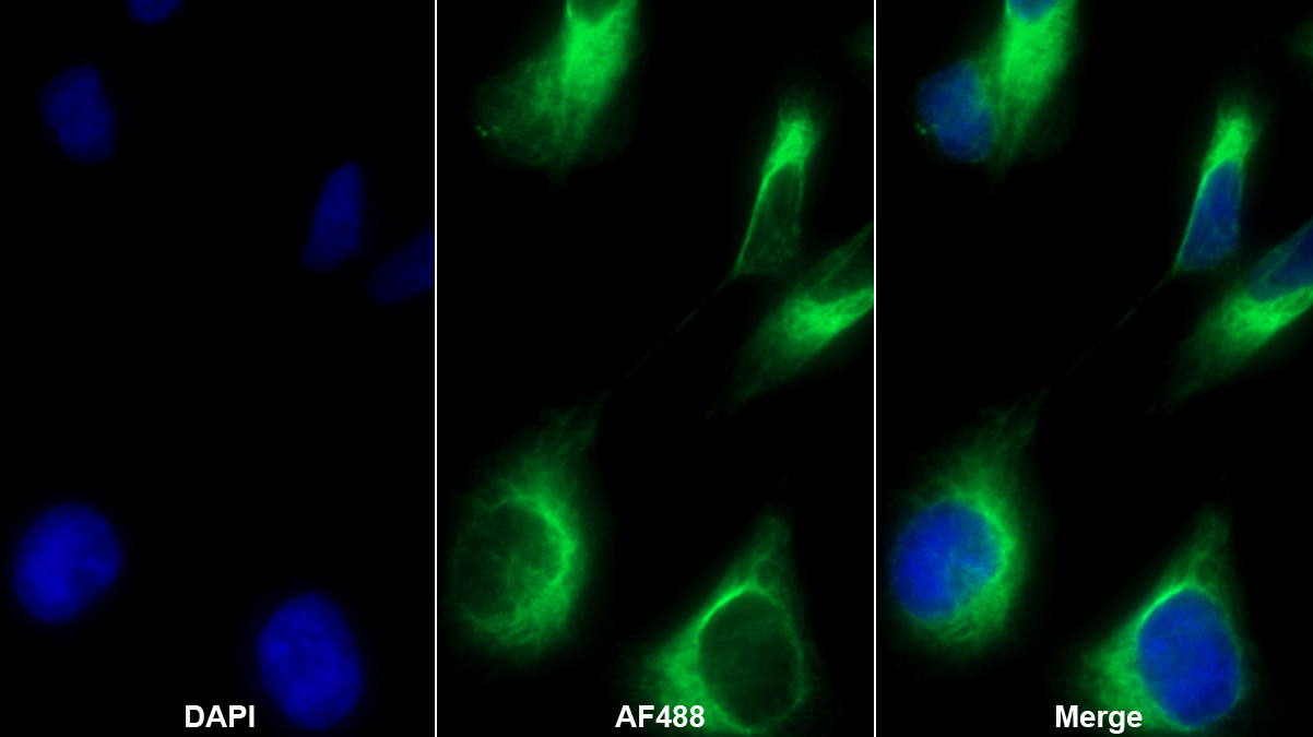 Polyclonal Antibody to Nestin (NES)