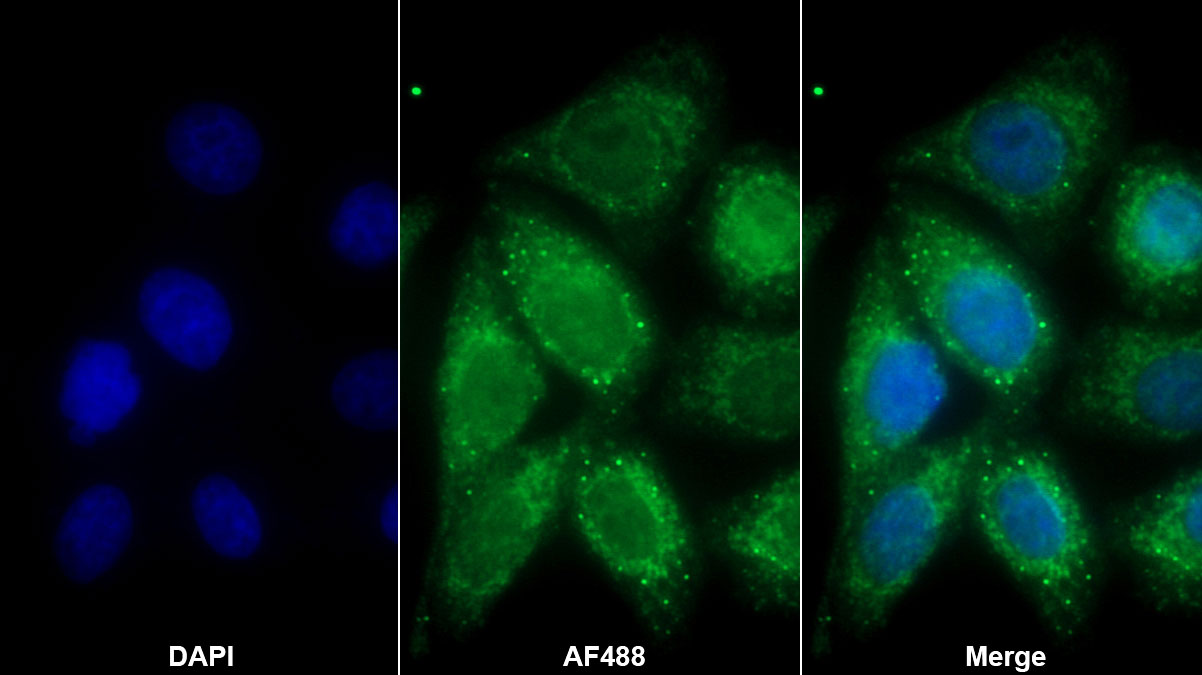 Polyclonal Antibody to Natriuretic Peptide Precursor B (NPPB)