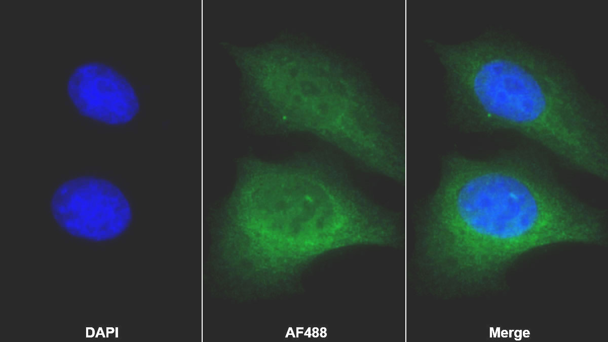 Polyclonal Antibody to Platelet Derived Growth Factor Subunit A (PDGFA)