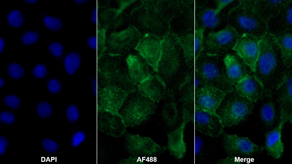 Polyclonal Antibody to Thrombomodulin (TM)