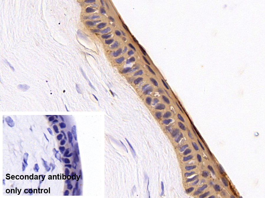Polyclonal Antibody to Cytokeratin 12 (CK12)