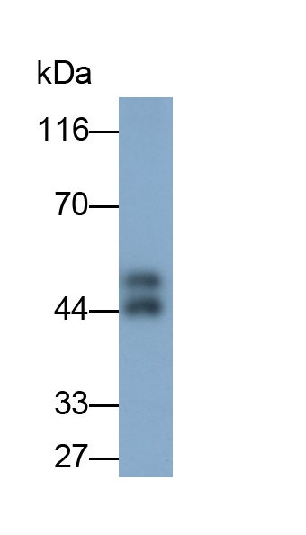 Polyclonal Antibody to Enolase, Neuron Specific (NSE)