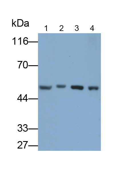 Polyclonal Antibody to Enolase, Neuron Specific (NSE)