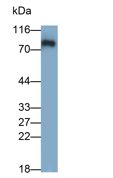 Polyclonal Antibody to Immunoglobulin M (IgM)