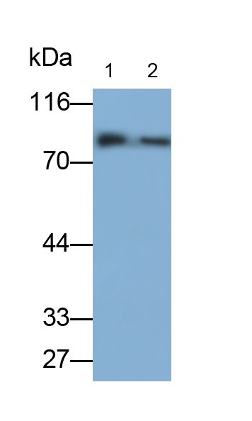 Polyclonal Antibody to Immunoglobulin M (IgM)