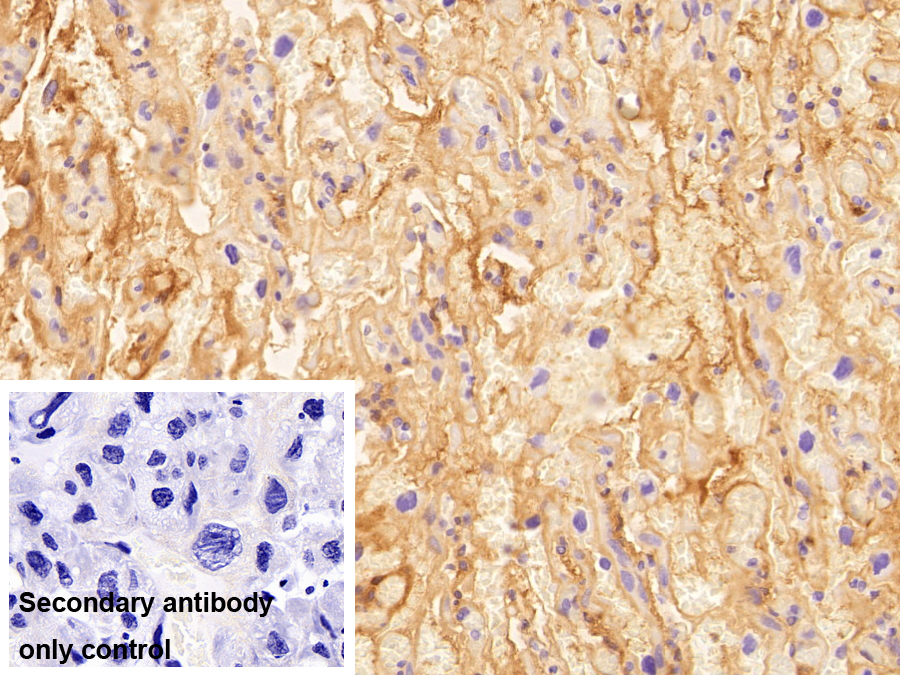 Polyclonal Antibody to Immunoglobulin M (IgM)