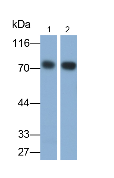 Polyclonal Antibody to Immunoglobulin E (IgE)