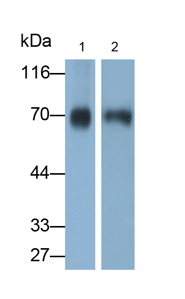 Polyclonal Antibody to Immunoglobulin A (IgA)