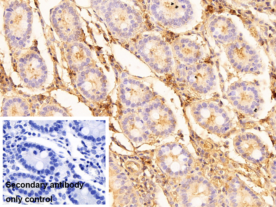 Polyclonal Antibody to Immunoglobulin A (IgA)