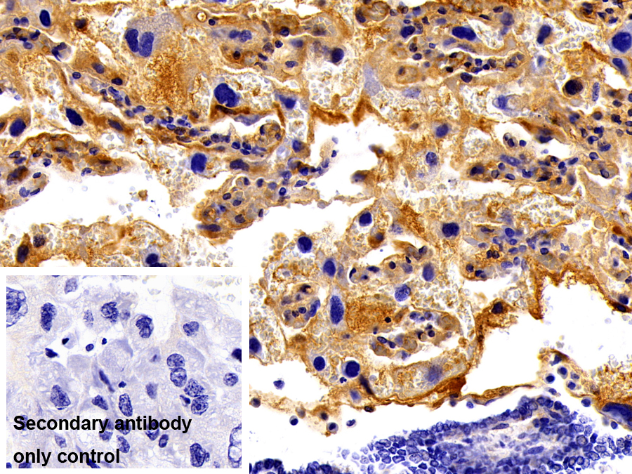 Polyclonal Antibody to Immunoglobulin A (IgA)