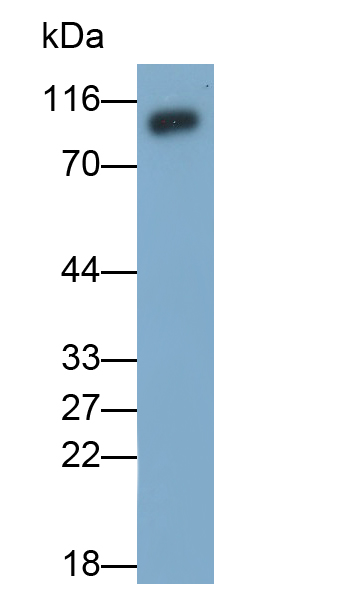 Polyclonal Antibody to Vascular Cell Adhesion Molecule 1 (VCAM1)