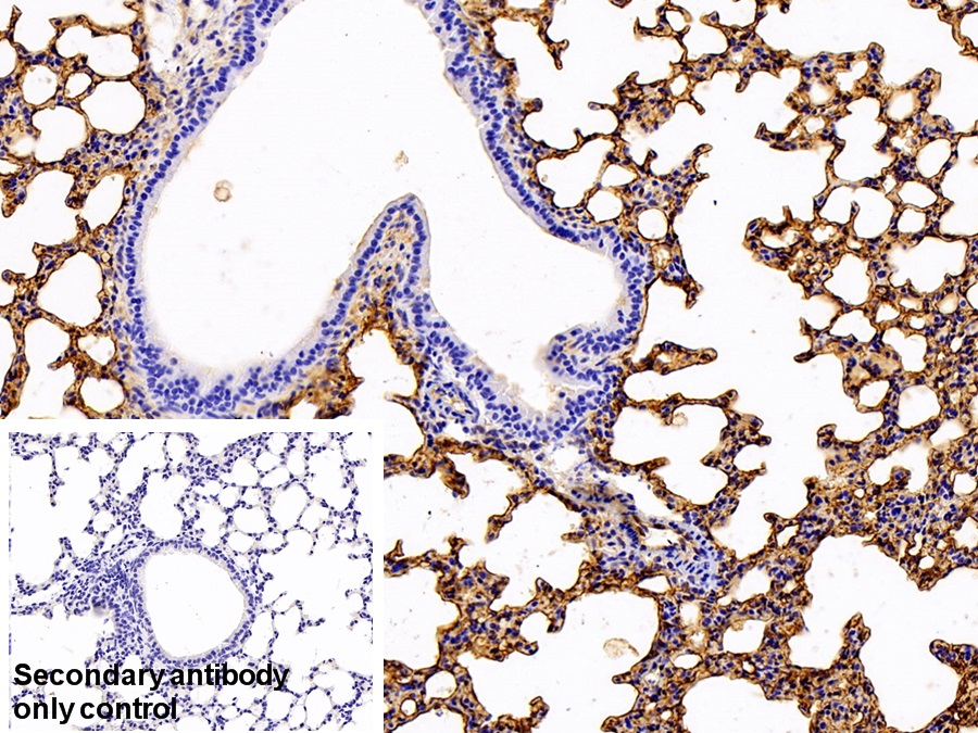 Polyclonal Antibody to Intercellular Adhesion Molecule 1 (ICAM1)