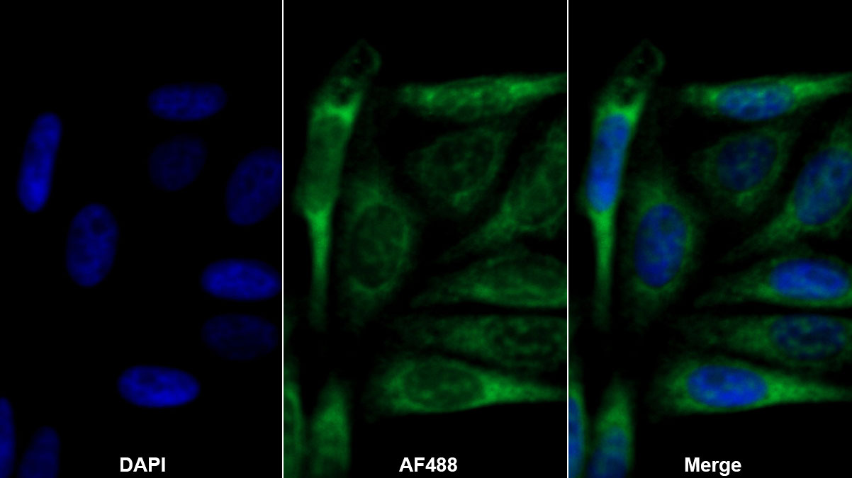 Polyclonal Antibody to Tissue Inhibitors Of Metalloproteinase 1 (TIMP1)