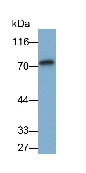 Polyclonal Antibody to Matrix Metalloproteinase 9 (MMP9)