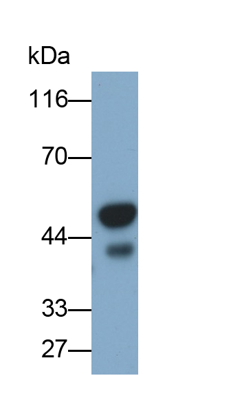 Polyclonal Antibody to Cytokeratin 7 (CK7)