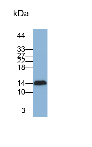 Polyclonal Antibody to Fatty Acid Binding Protein 2, Intestinal (FABP2)