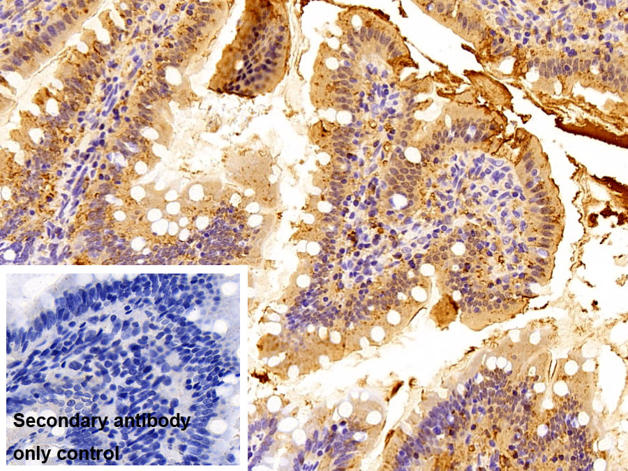 Polyclonal Antibody to Fatty Acid Binding Protein 2, Intestinal (FABP2)