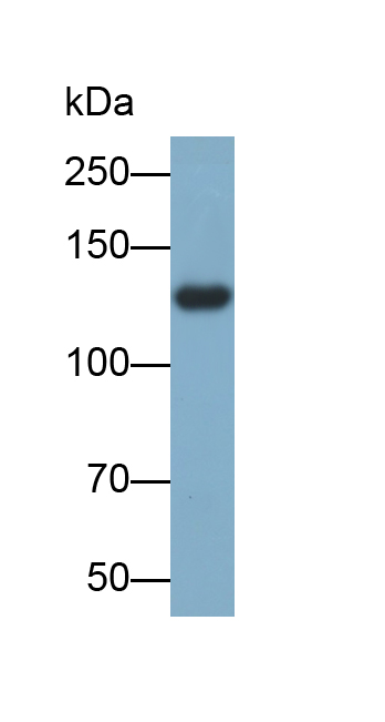 Polyclonal Antibody to Epidermal Growth Factor (EGF)