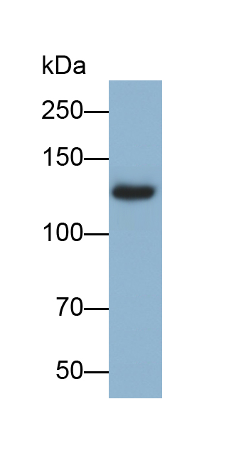 Polyclonal Antibody to Epidermal Growth Factor (EGF)