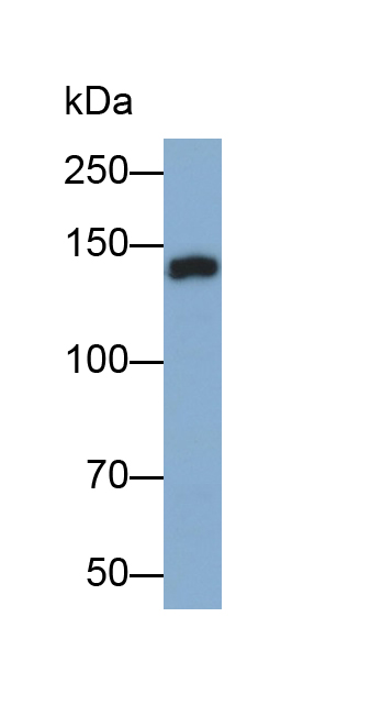 Polyclonal Antibody to Epidermal Growth Factor (EGF)