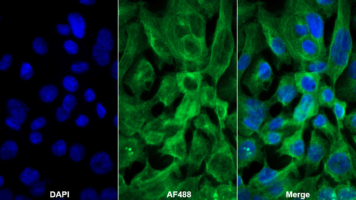 Polyclonal Antibody to Leukemia Inhibitory Factor Receptor (LIFR)