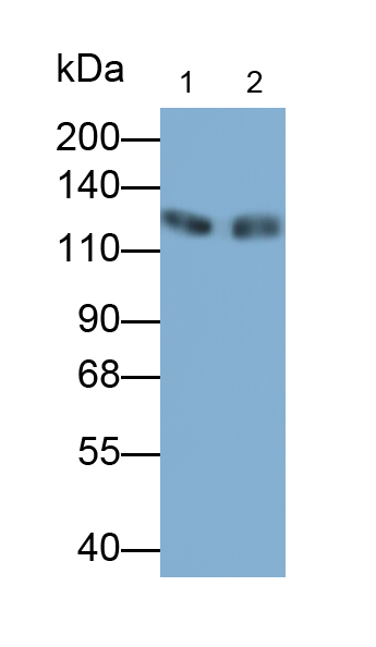 Polyclonal Antibody to Leukemia Inhibitory Factor Receptor (LIFR)