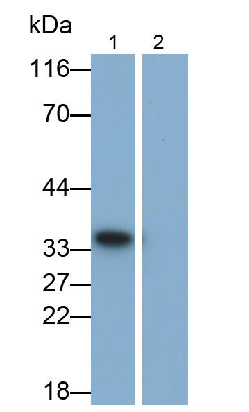 Polyclonal Antibody to Interleukin 1 Beta (IL1b)