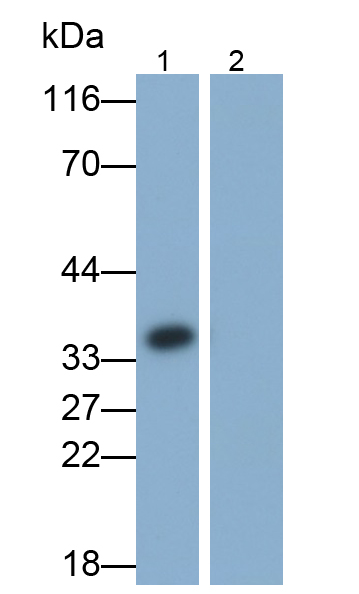 Polyclonal Antibody to Interleukin 1 Beta (IL1b)