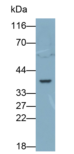 Polyclonal Antibody to Interleukin 1 Beta (IL1b)