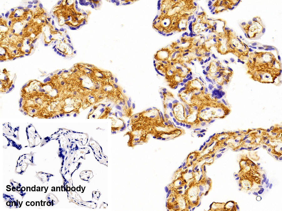 Polyclonal Antibody to Procollagen III N-Terminal Propeptide (PIIINP)