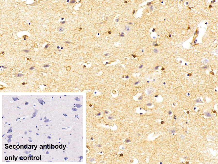 Polyclonal Antibody to Procollagen III N-Terminal Propeptide (PIIINP)