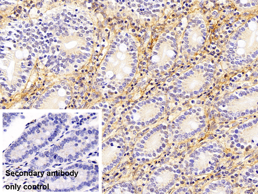 Polyclonal Antibody to Procollagen III N-Terminal Propeptide (PIIINP)