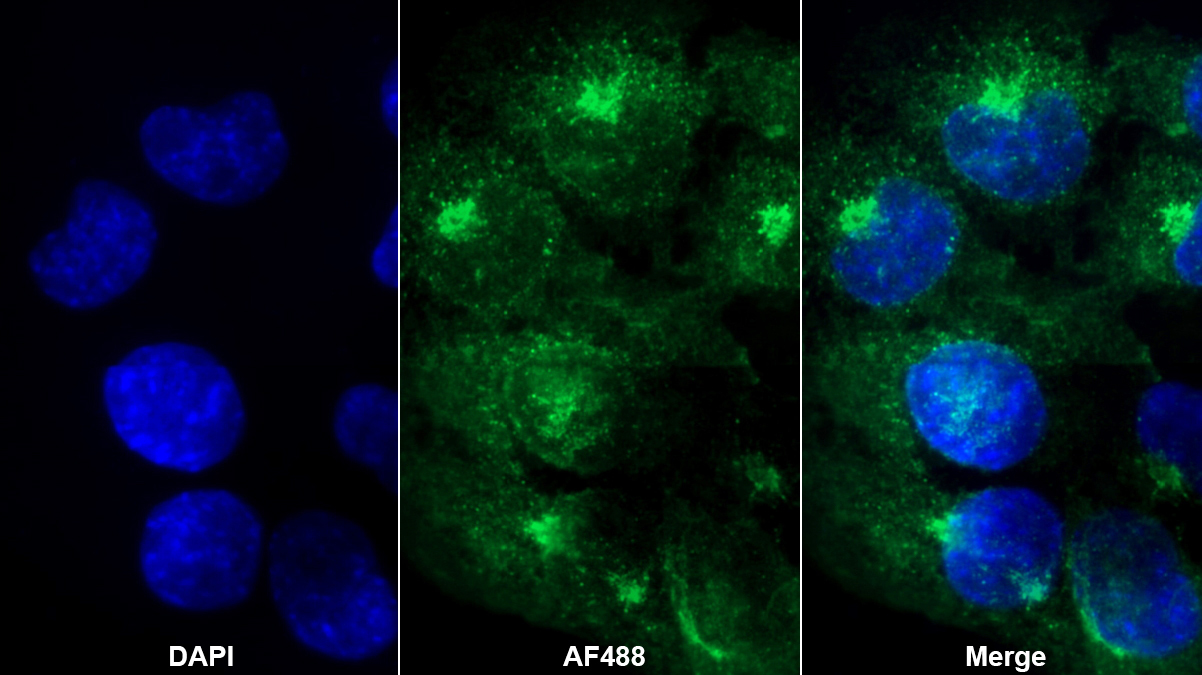 Polyclonal Antibody to Laminin Alpha 1 (LAMA1)