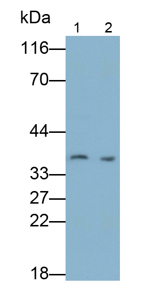 Polyclonal Antibody to Cyclin D1 (CCND1)