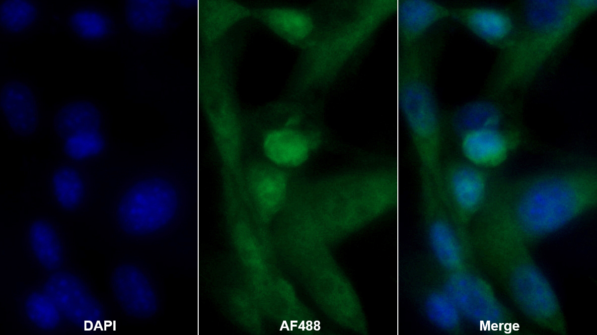 Polyclonal Antibody to Cyclin D1 (CCND1)