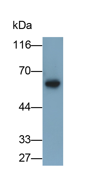 Polyclonal Antibody to Pyruvate kinase isozymes M2 (PKM2)