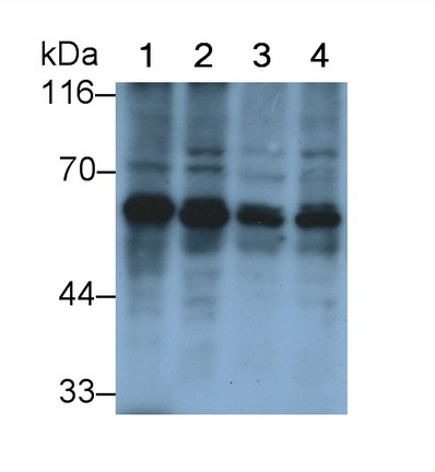 Polyclonal Antibody to Pyruvate kinase isozymes M2 (PKM2)