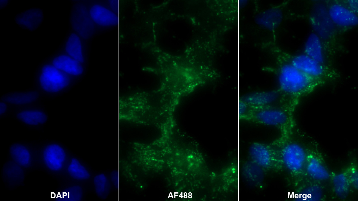 Polyclonal Antibody to Fibrillin 1 (FBN1)