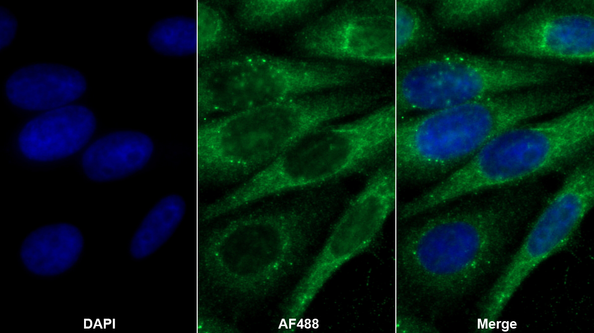 Polyclonal Antibody to Apolipoprotein B100 (APOB100)