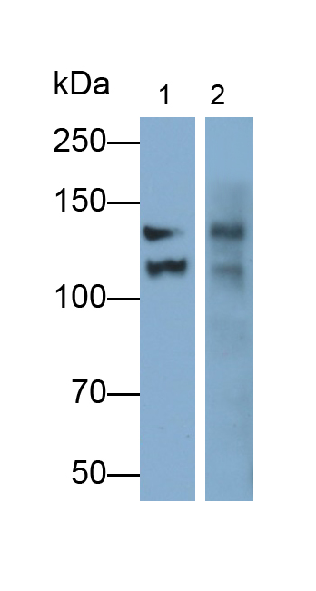 Polyclonal Antibody to Thrombospondin 1 (THBS1)