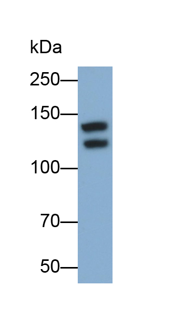 Polyclonal Antibody to Thrombospondin 1 (THBS1)