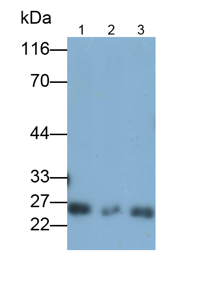 Polyclonal Antibody to Glutathione S Transferase Theta 2 (GSTt2)