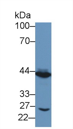 Polyclonal Antibody to Tachykinin Receptor 2 (TACR2)