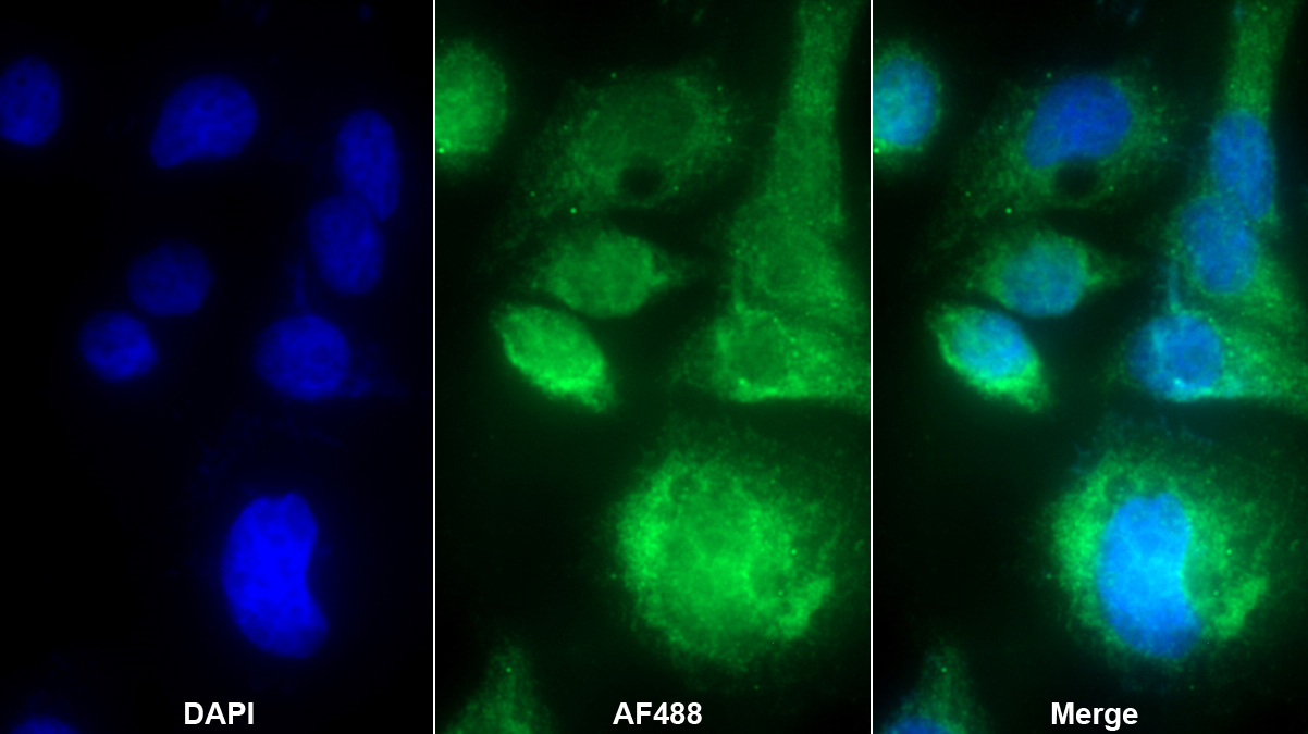 Polyclonal Antibody to Midkine (MK)